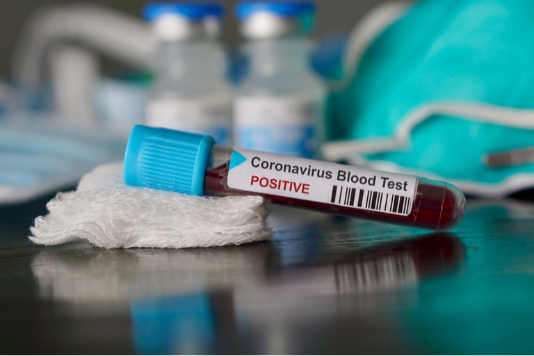 How can we prepare for the coronavirus? 3 questions answered